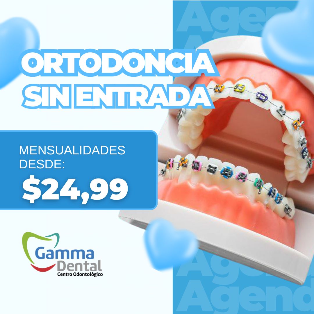 ORTODONCIA SIN ENTRADA